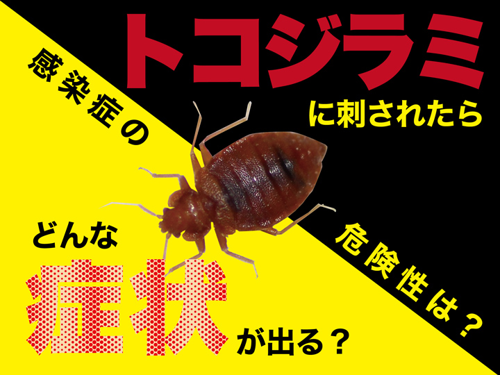 トコジラミに刺されたらどんな症状が出る？感染症の危険性は？