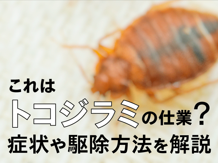 これってトコジラミの仕業？噛まれたときの症状や駆除方法を教えます！